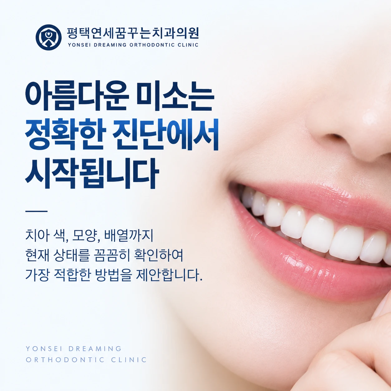 심미 치아 색이나 모양이 신경 쓰일 때 가장 먼저 무엇을 확인해야 할까요?