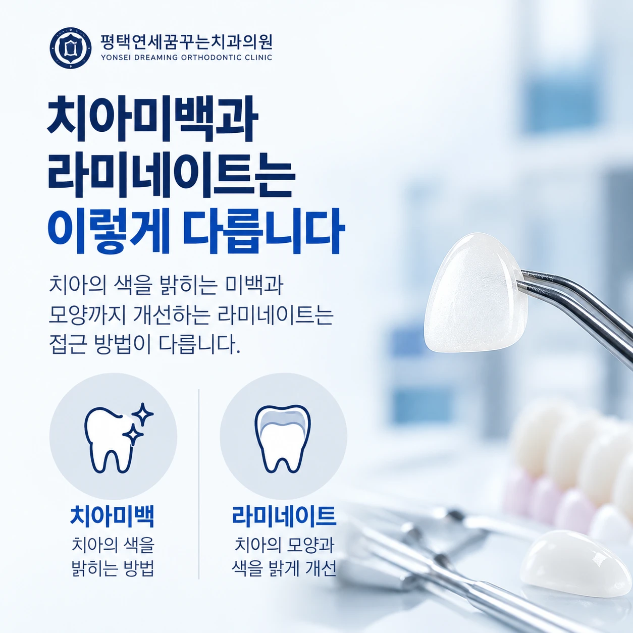 심미 미백과 라미네이트는 어떤 차이가 있을까요?
