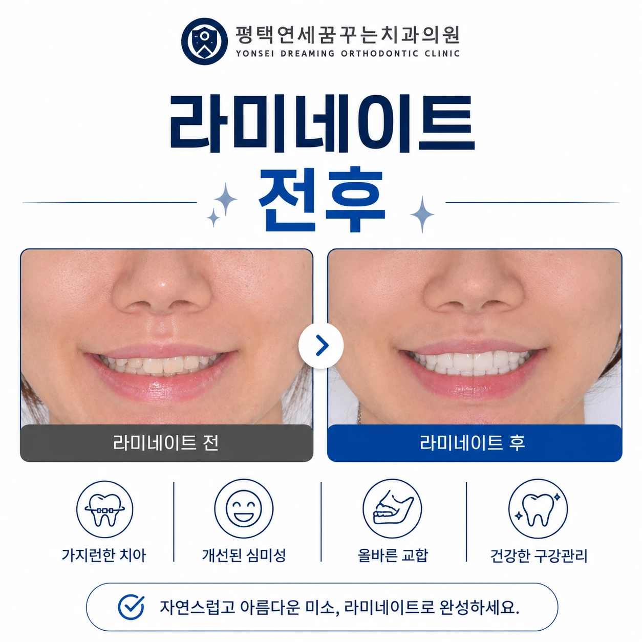 치과소개 치아를 더 예쁘게 만들고 싶다면 어떤 부분부터 확인할까요?