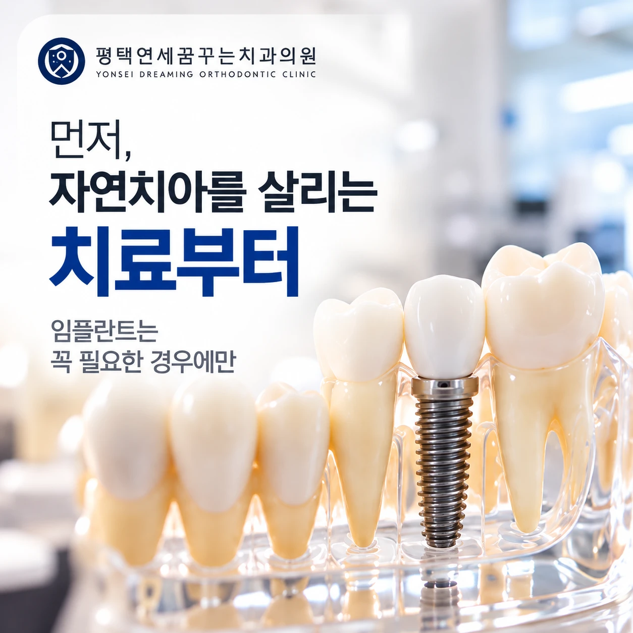 임플란트 진료 안내: 임플란트를 고민하시는 분들께 제가 가장 먼저 확인하는 것은 무엇일까요?