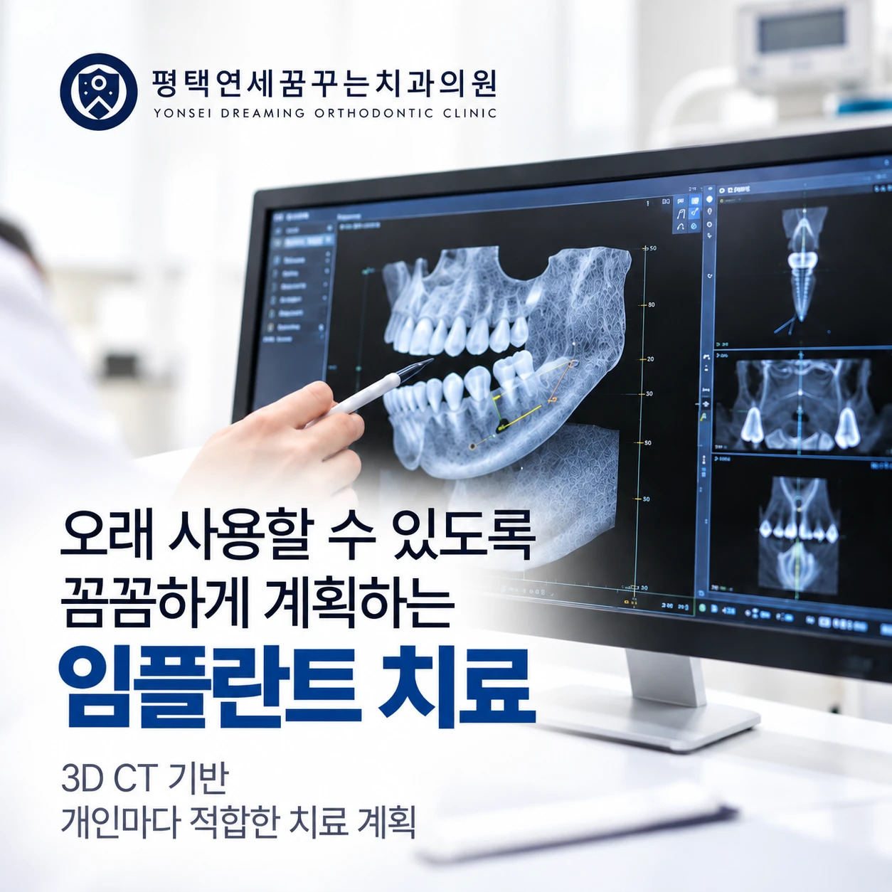 임플란트 진료 안내: 실제 임플란트 치료를 결정했다면 무엇을 중요하게 살펴볼까요?
