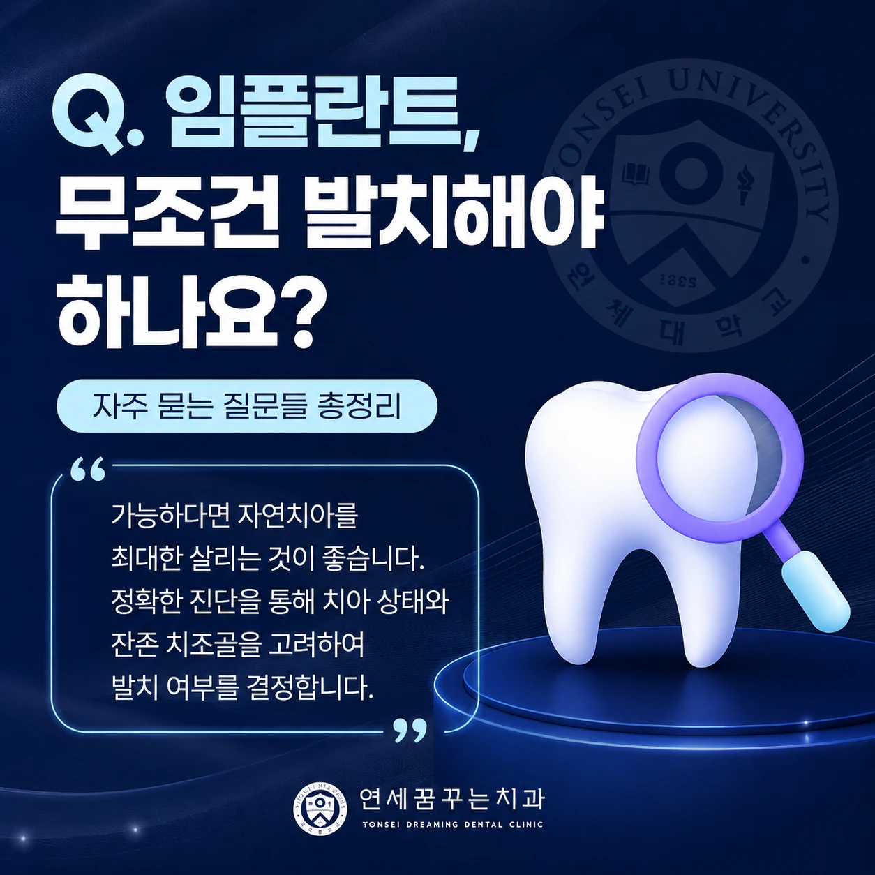 임플란트 자연치아를 먼저 살펴보는 이유는 무엇일까요?