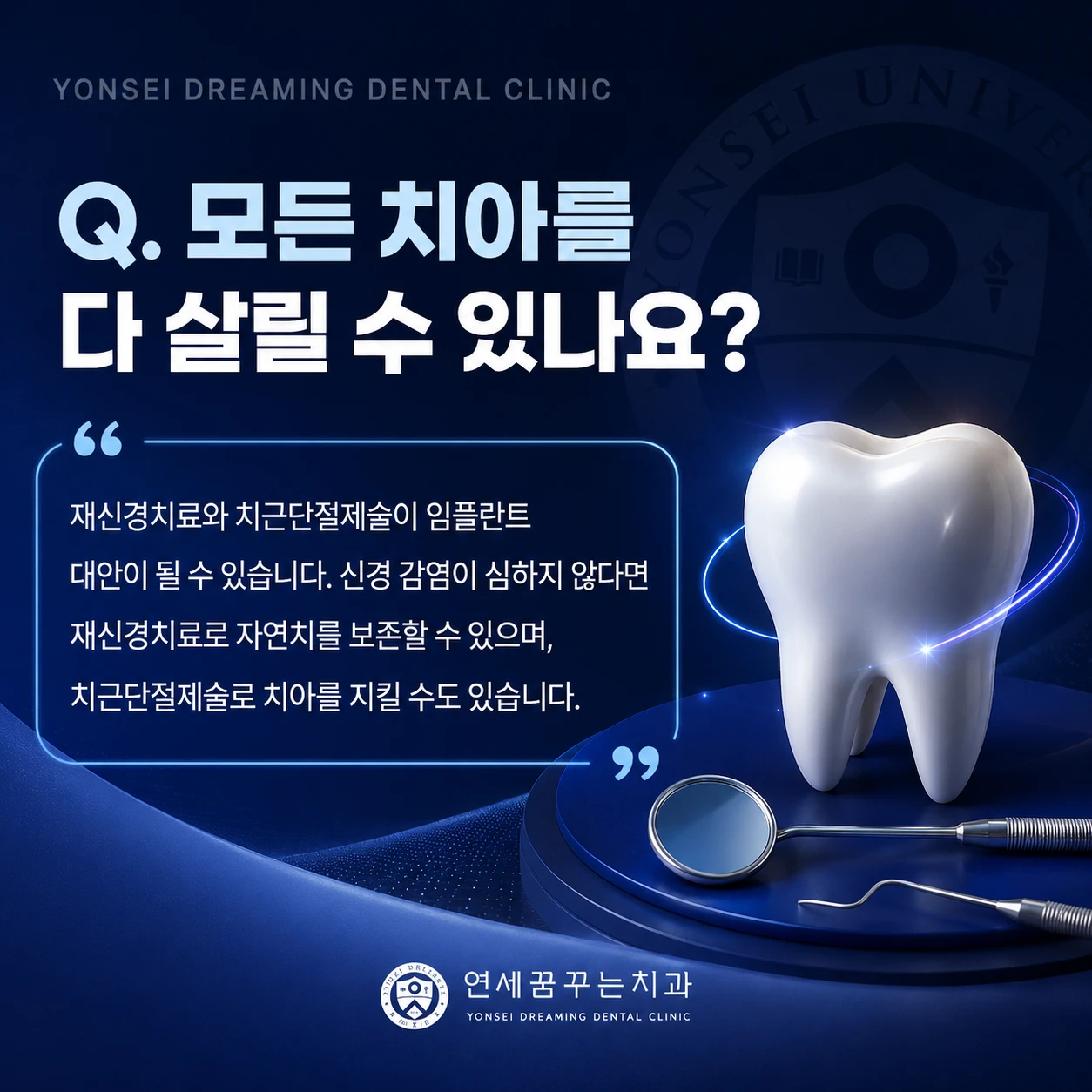 임플란트 발치 여부는 어떤 기준으로 결정하게 될까요?