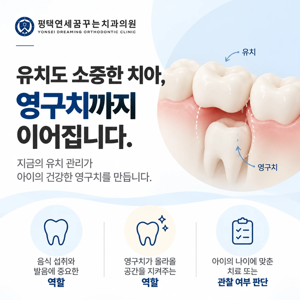 소아치과 진료 안내: 유치는 어차피 빠질 치아인데 충치를 꼭 치료해야 할까요?